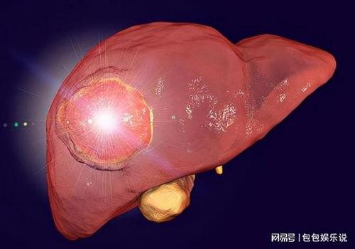 肝癌可以吃瓜吗,瓜类食物的适宜与禁忌