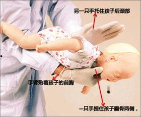 婴儿吃瓜卡喉咙,紧急应对与预防措施